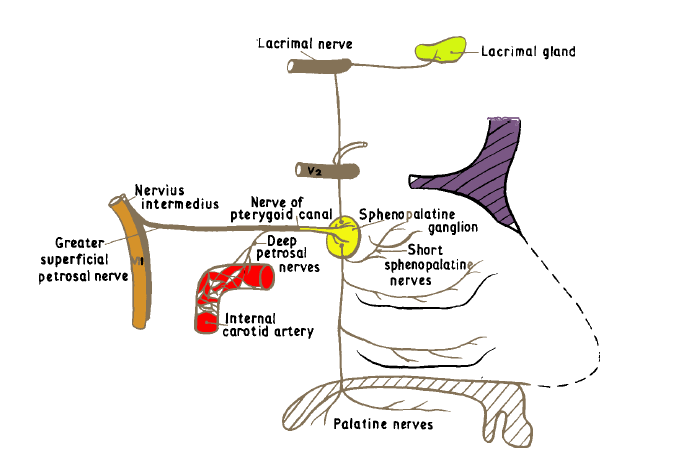 vidian neurectomy