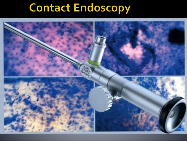 contact endoscopy